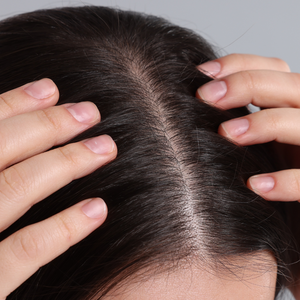 DRY HAIR & DRY SCALP